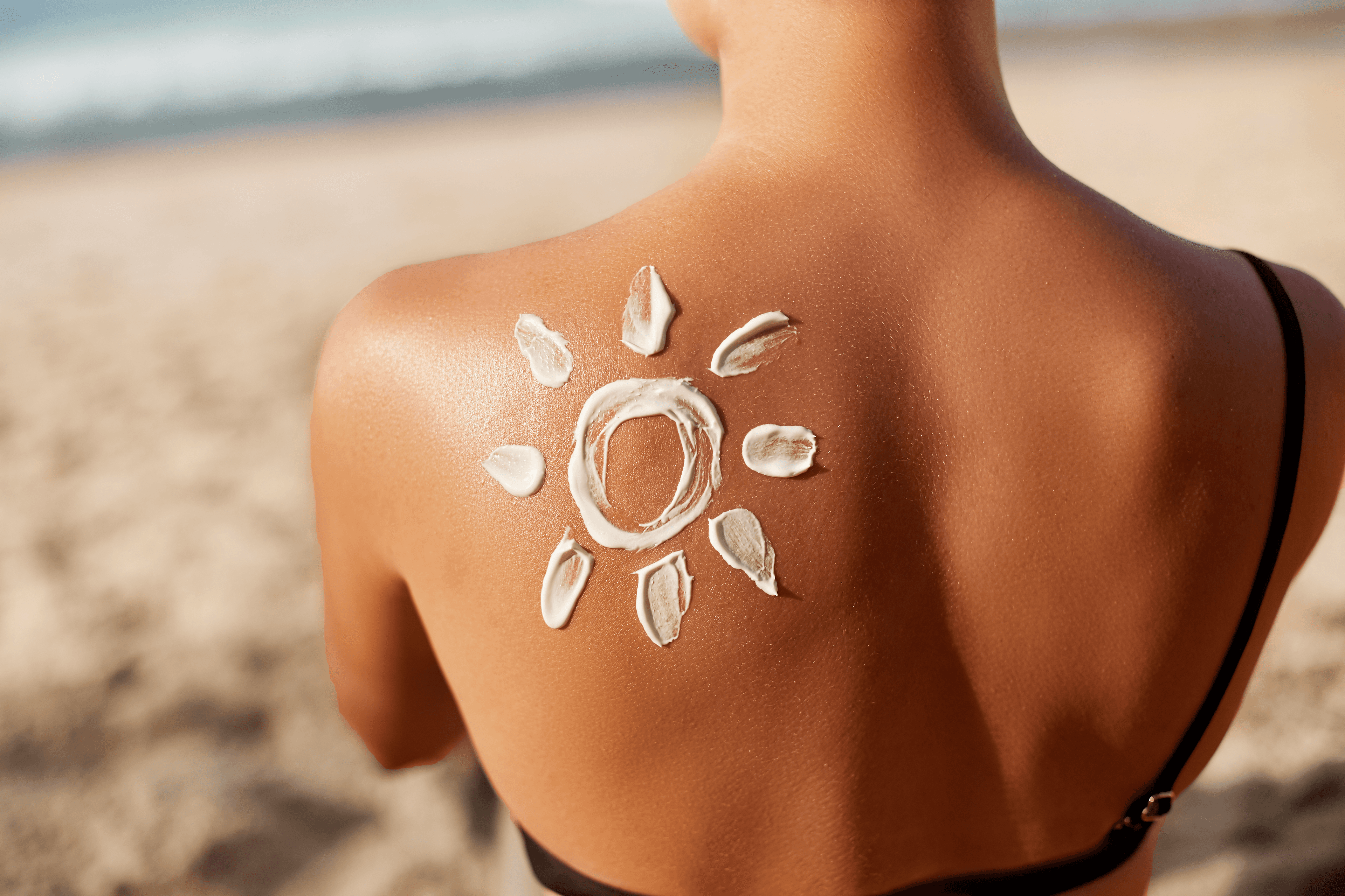 sunburn-care