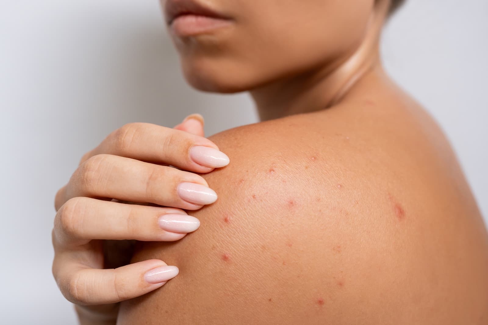 Red spots on body