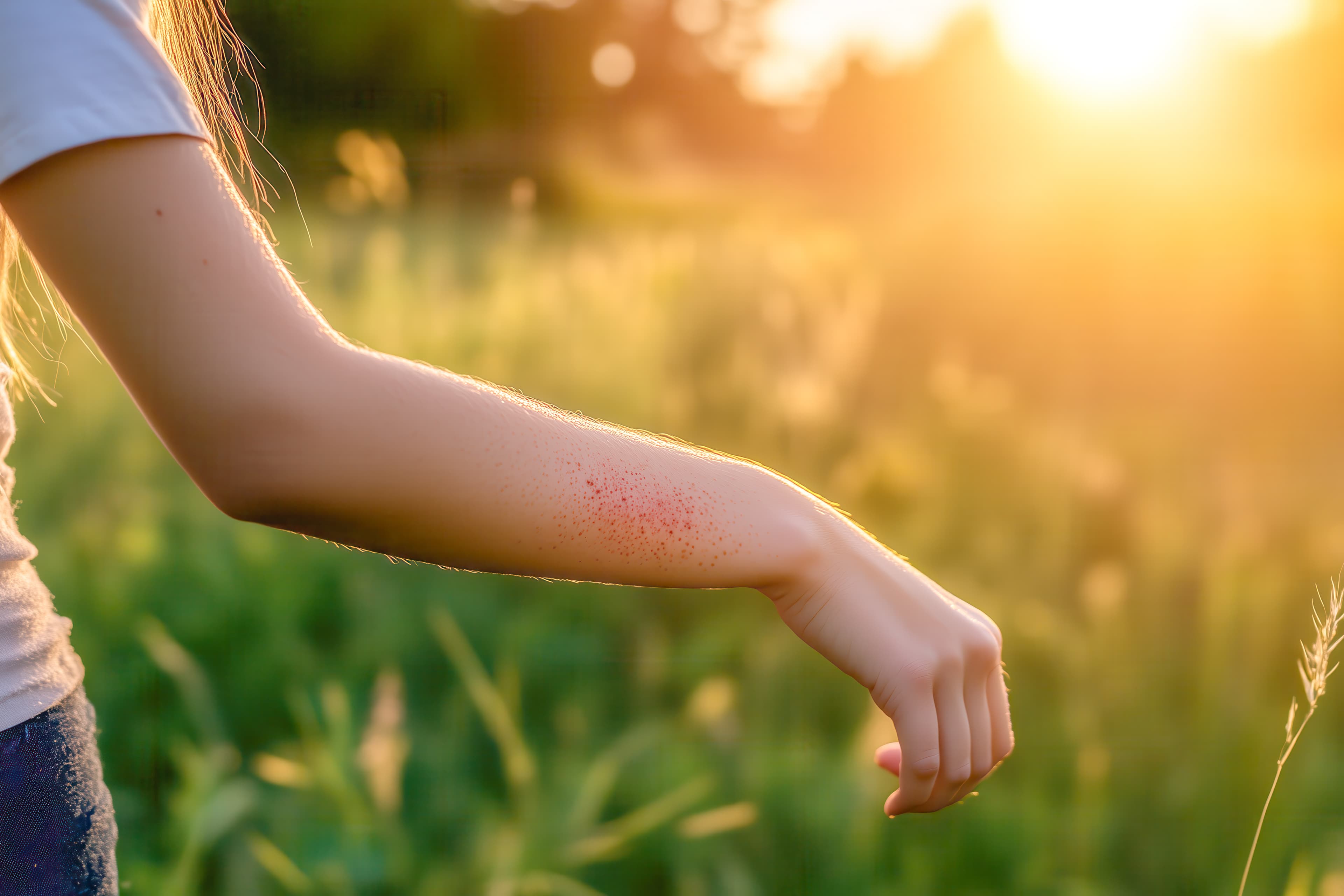 Poison Oak
