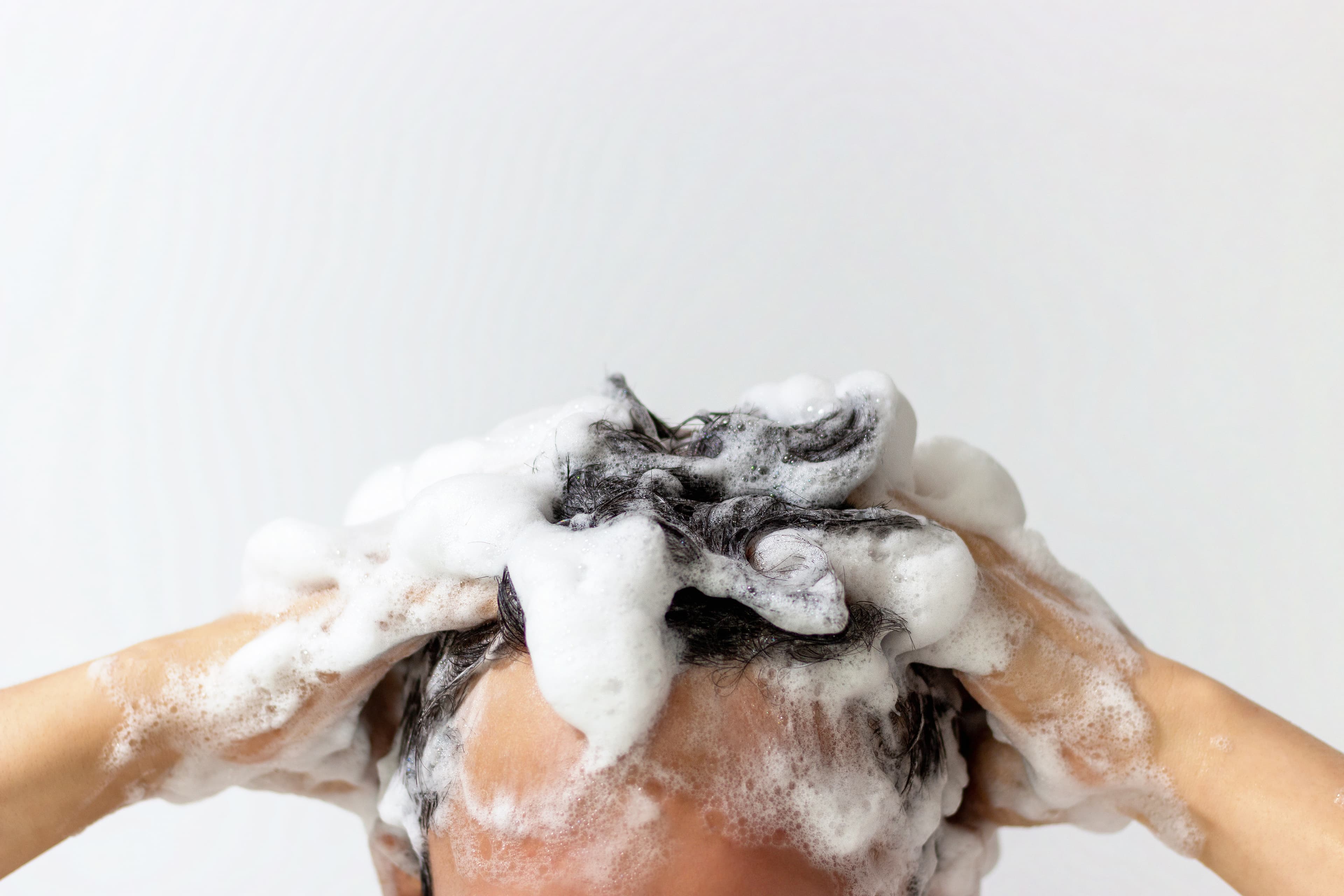 Head lice
