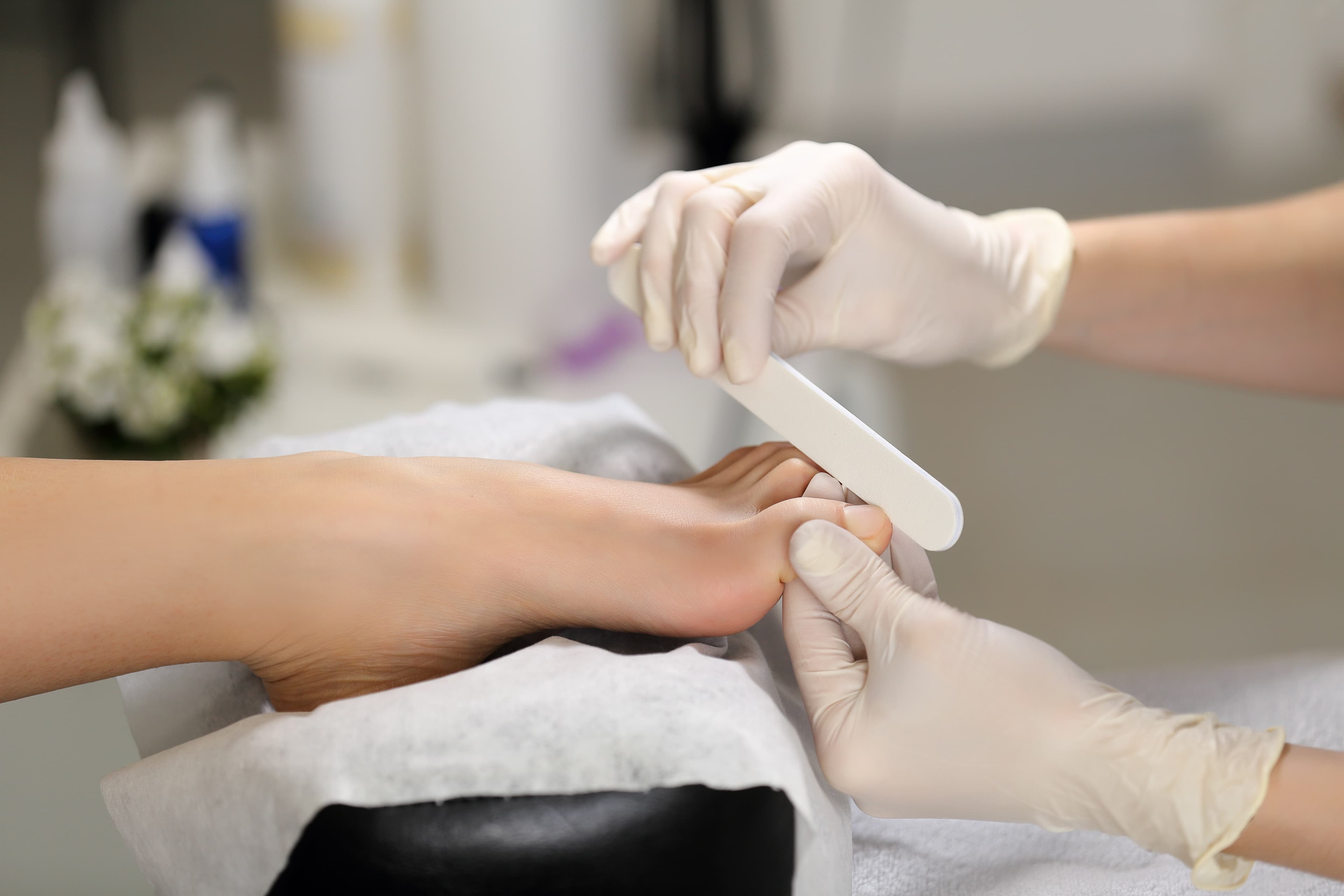 Fingernail or toenail fungus (onychomycosis)