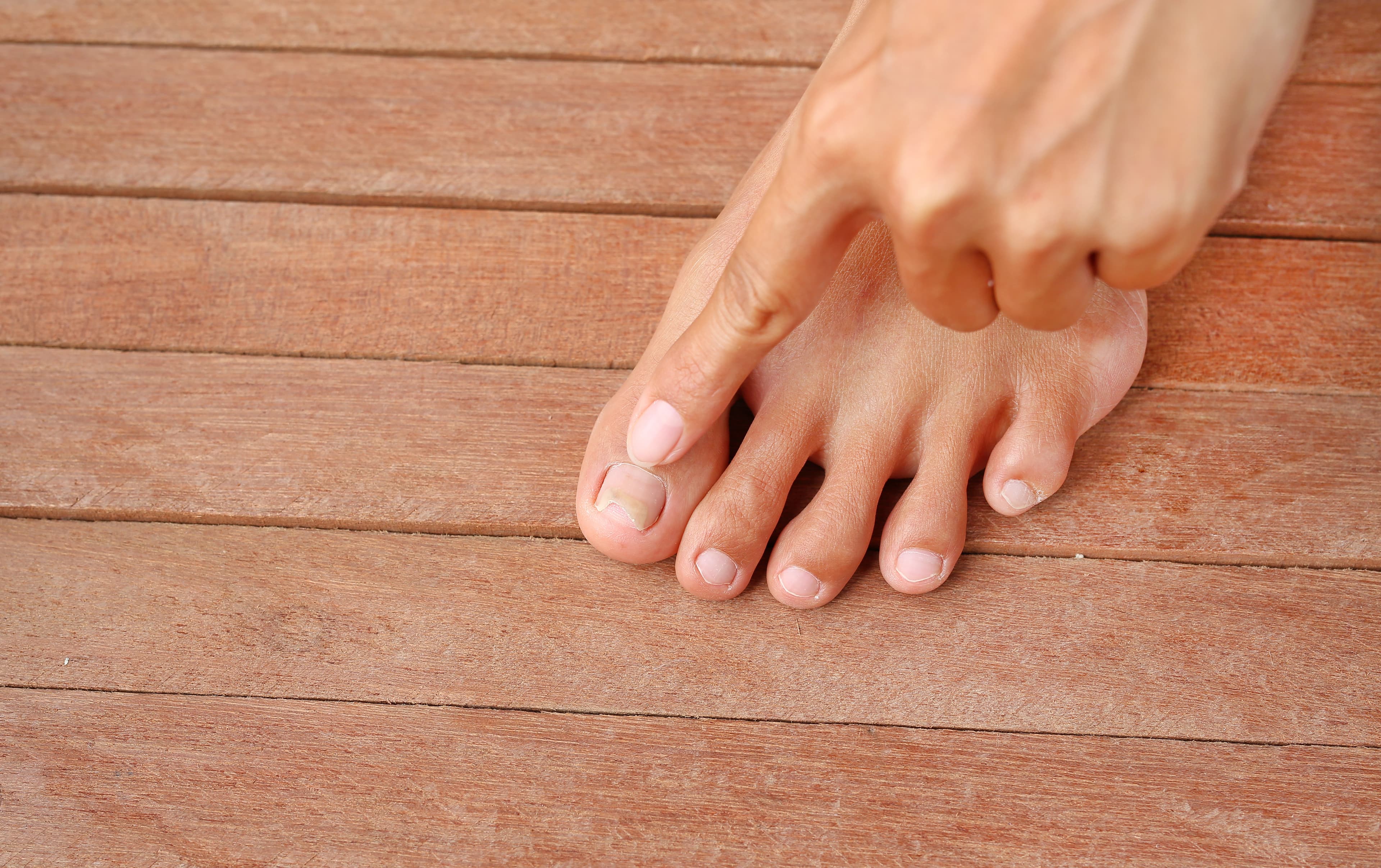 Ingrown toenail