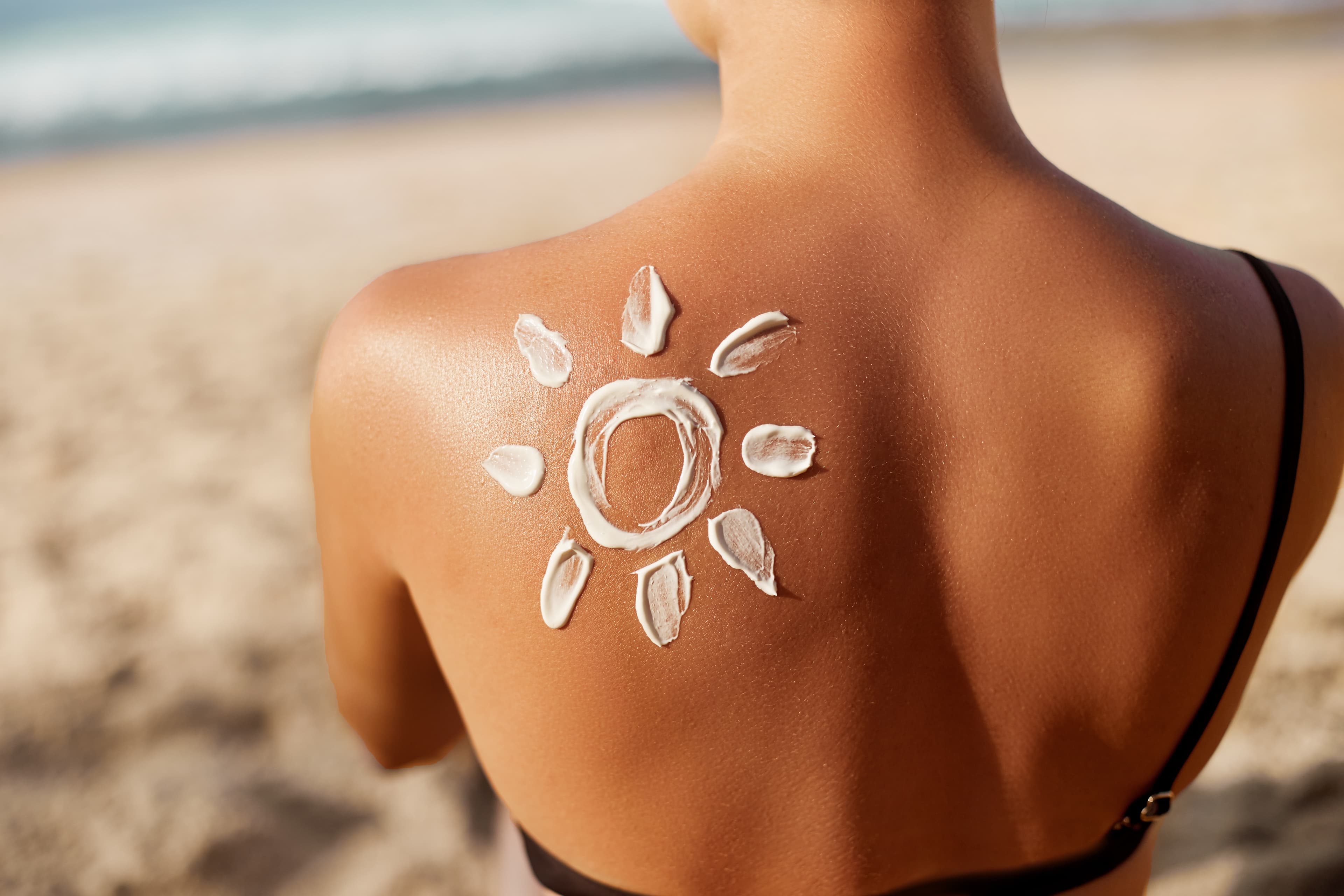 Sunburn Care