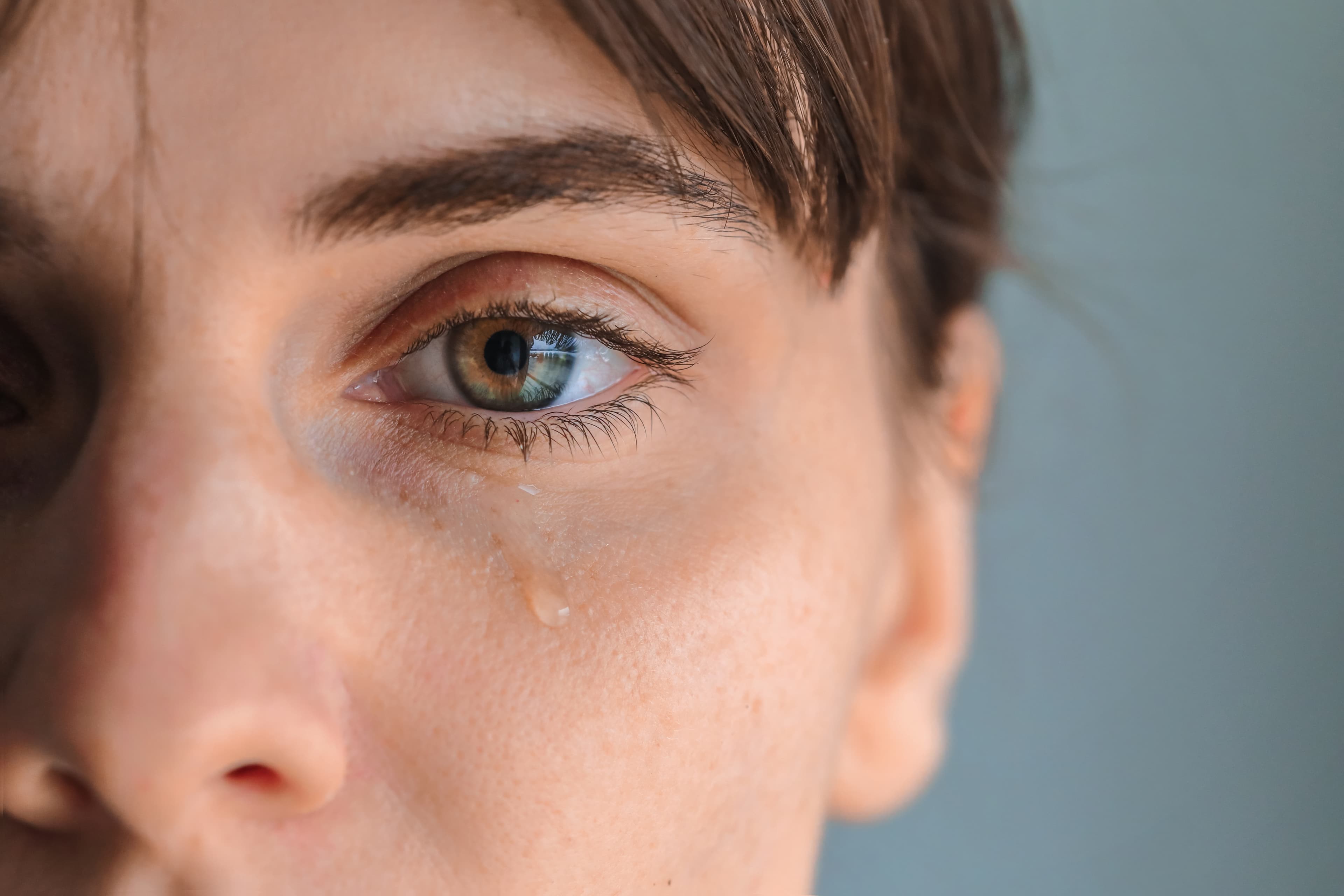 Excessive Eye Watering