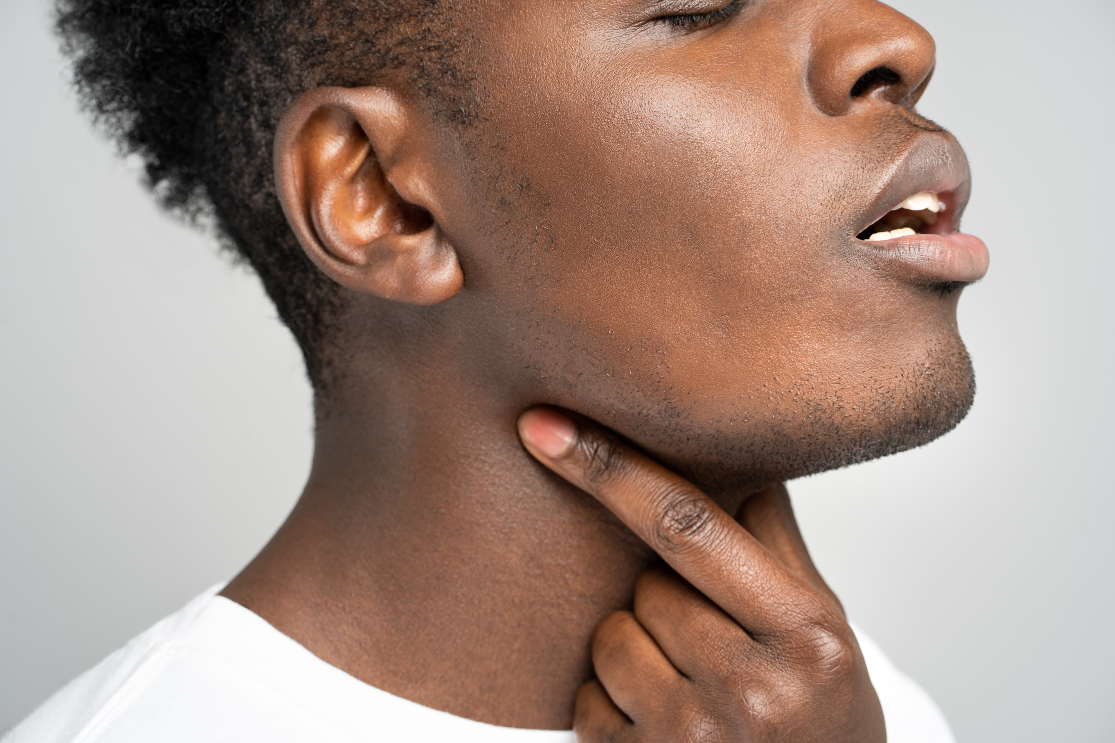 Laryngitis