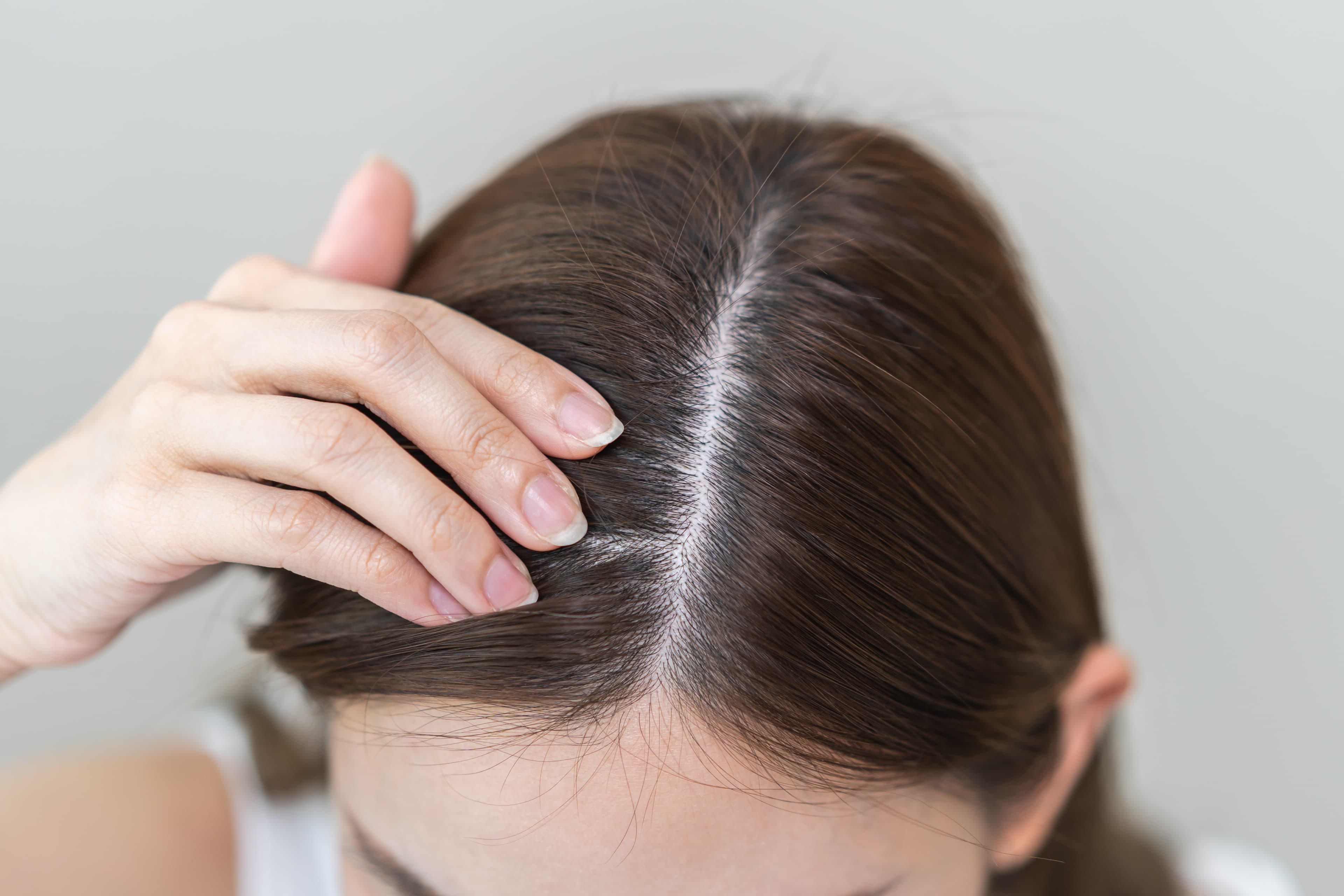 Itchy Scalp