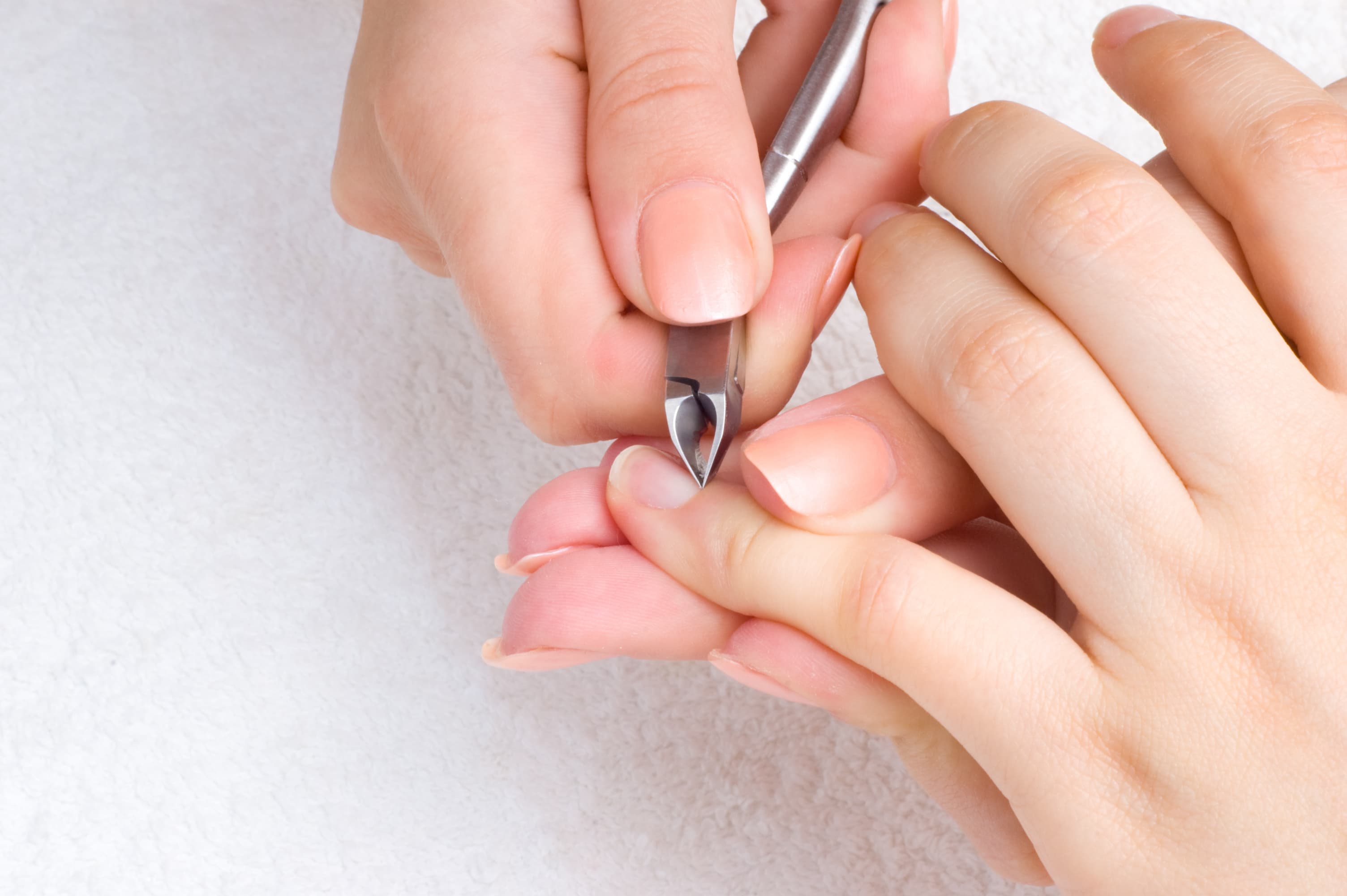 Hangnail