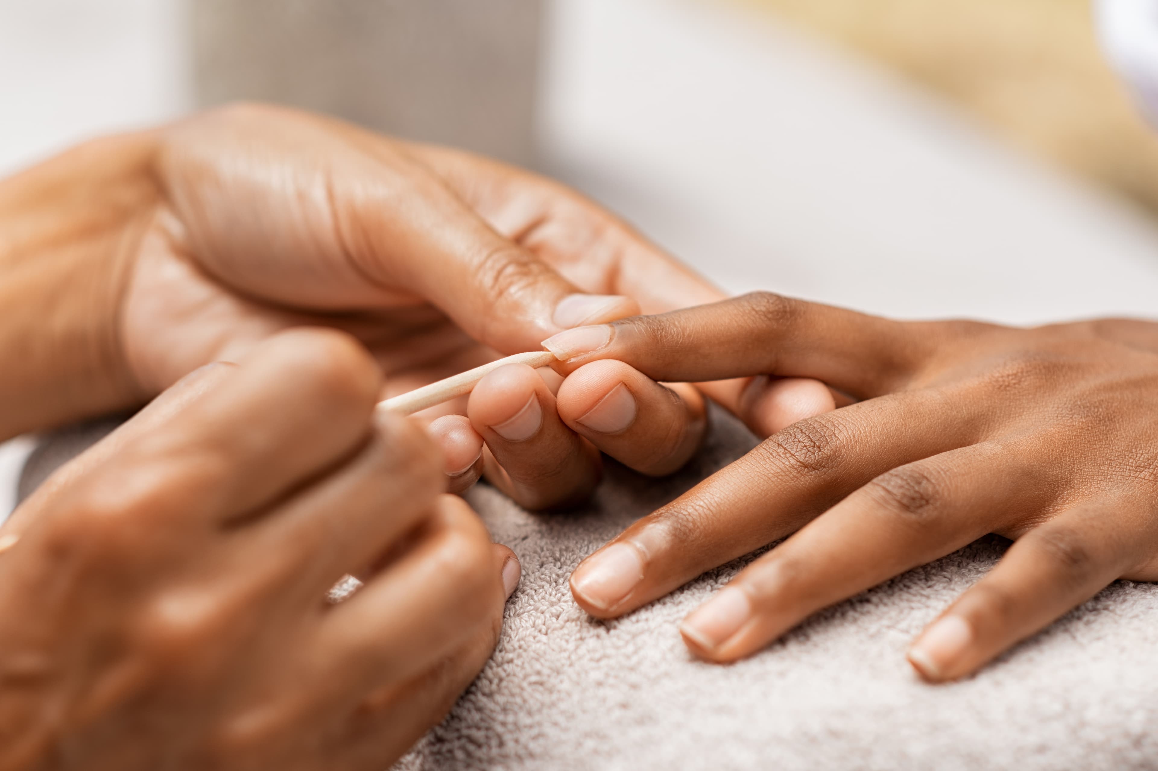 Irritated Cuticles