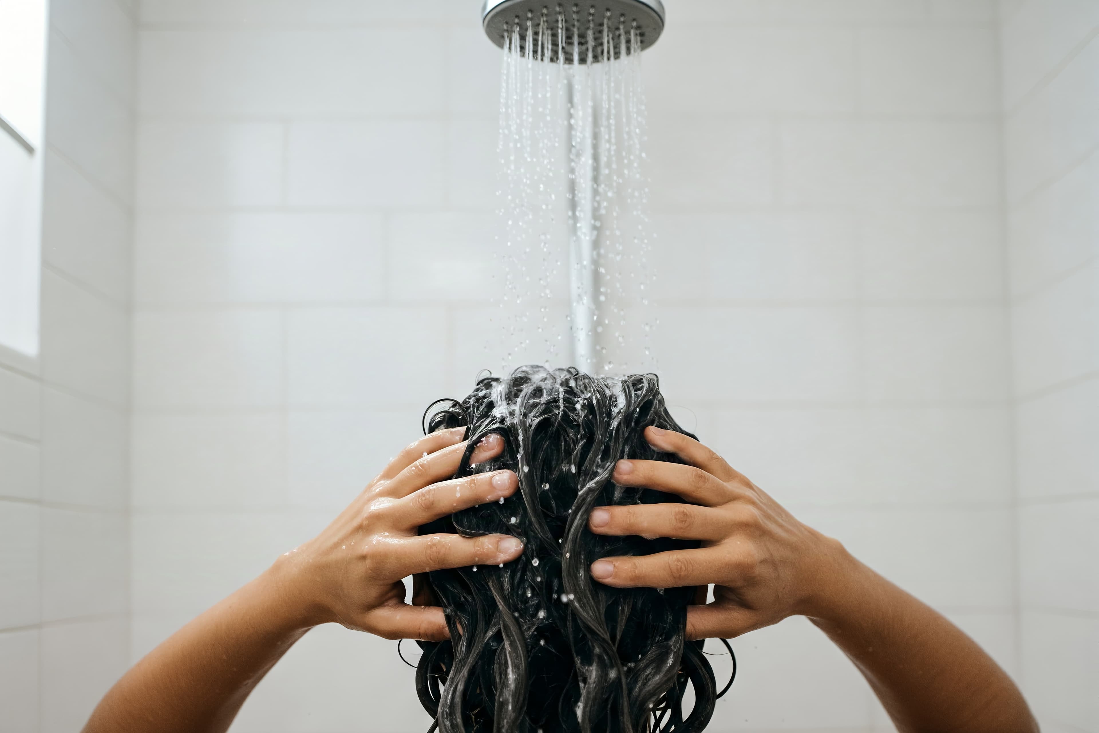 Scalp Fungal Infection (Tinea Capitis)