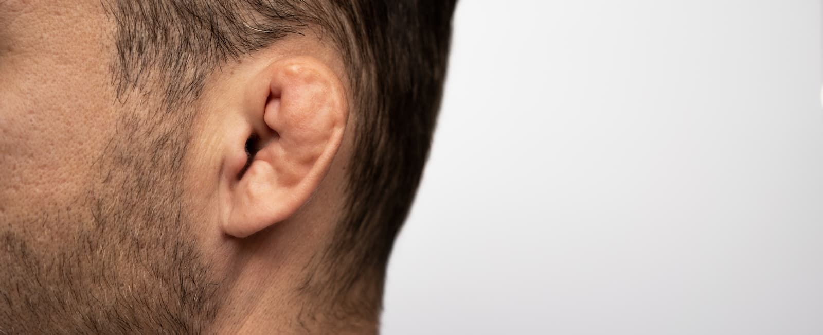 Cauliflower ear (Auricular Hematoma)