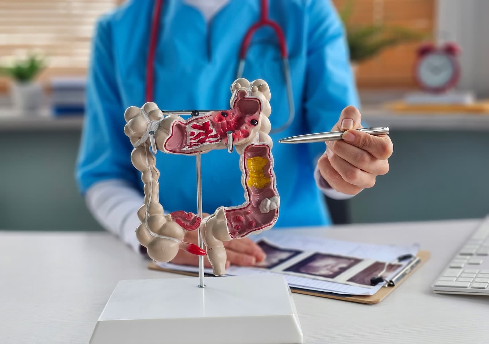 Colorectal cancer screening