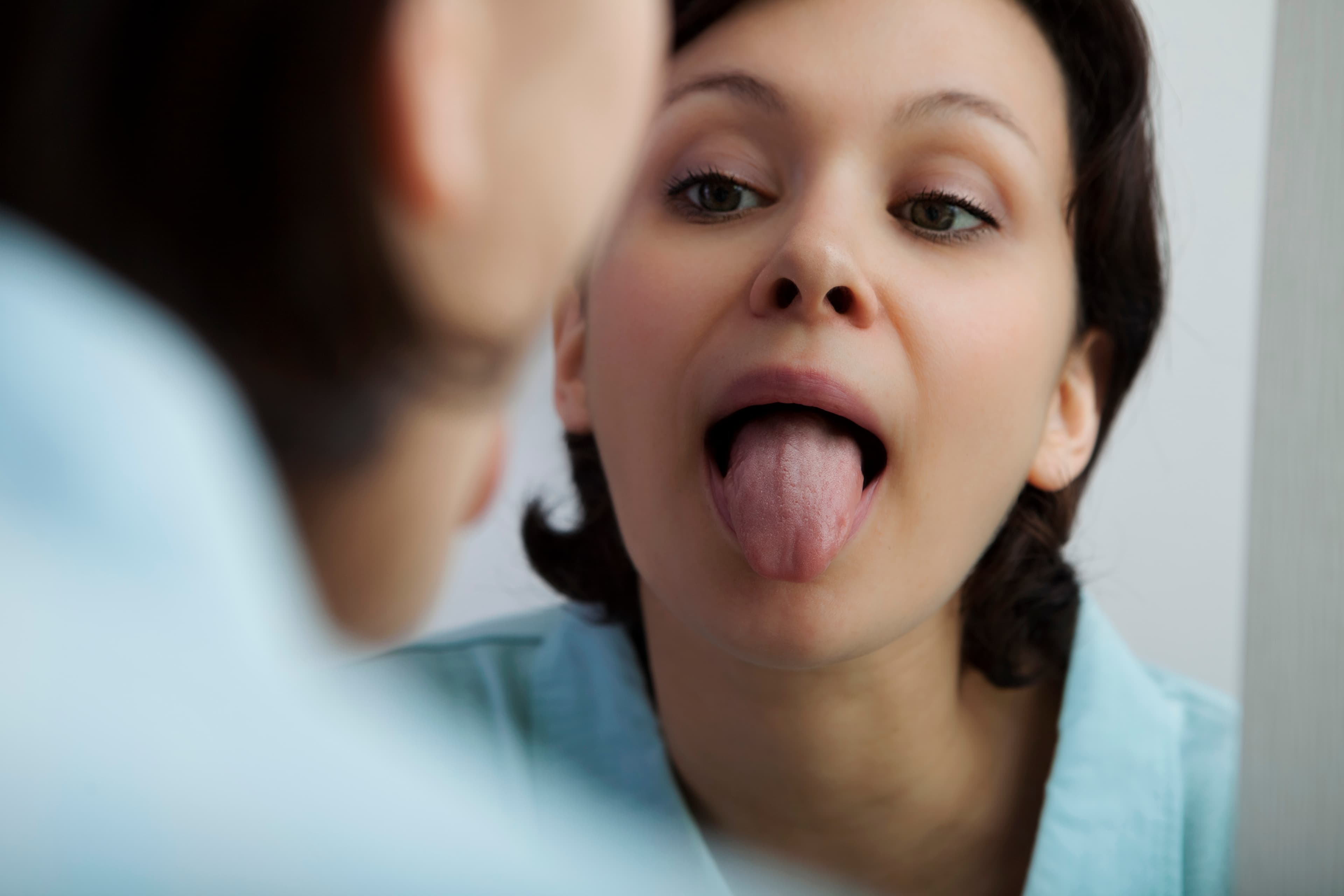 Cut tongue