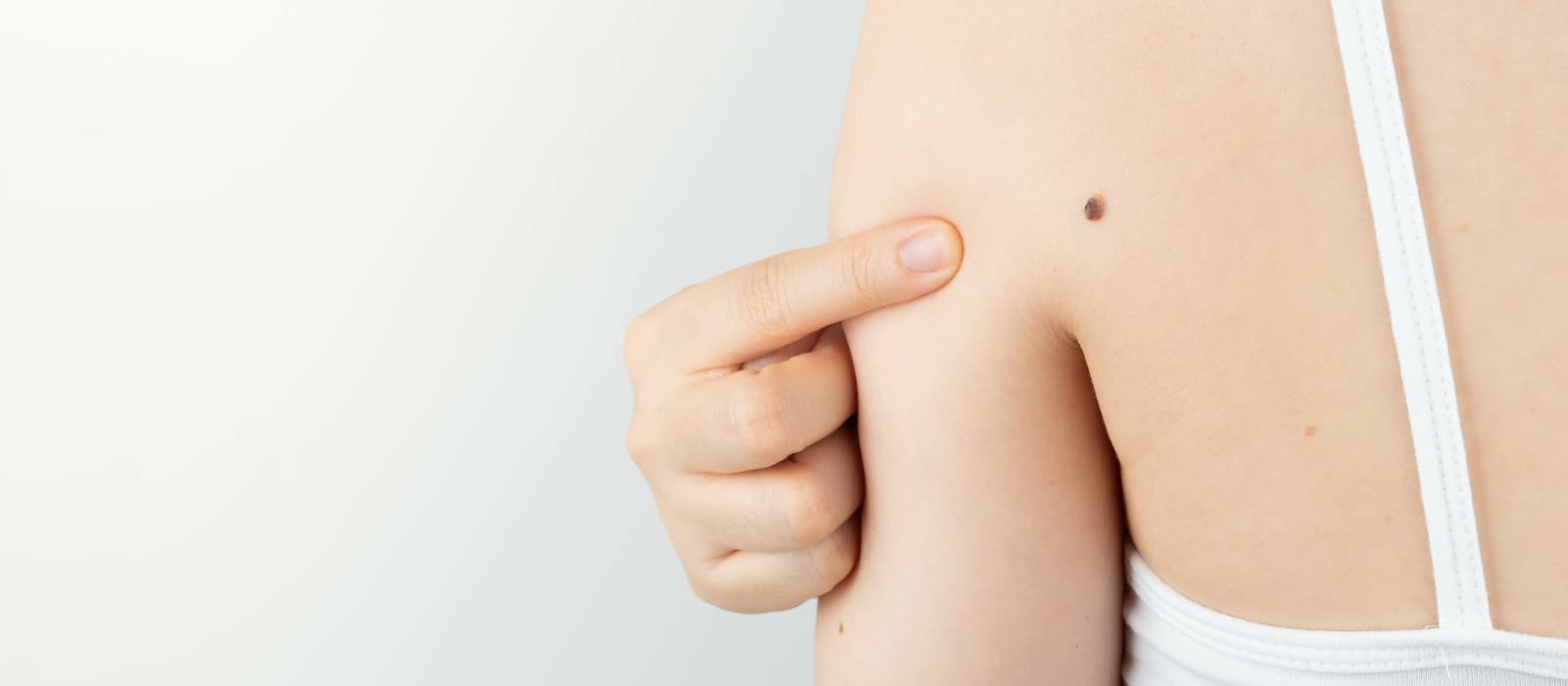 concerning-mole