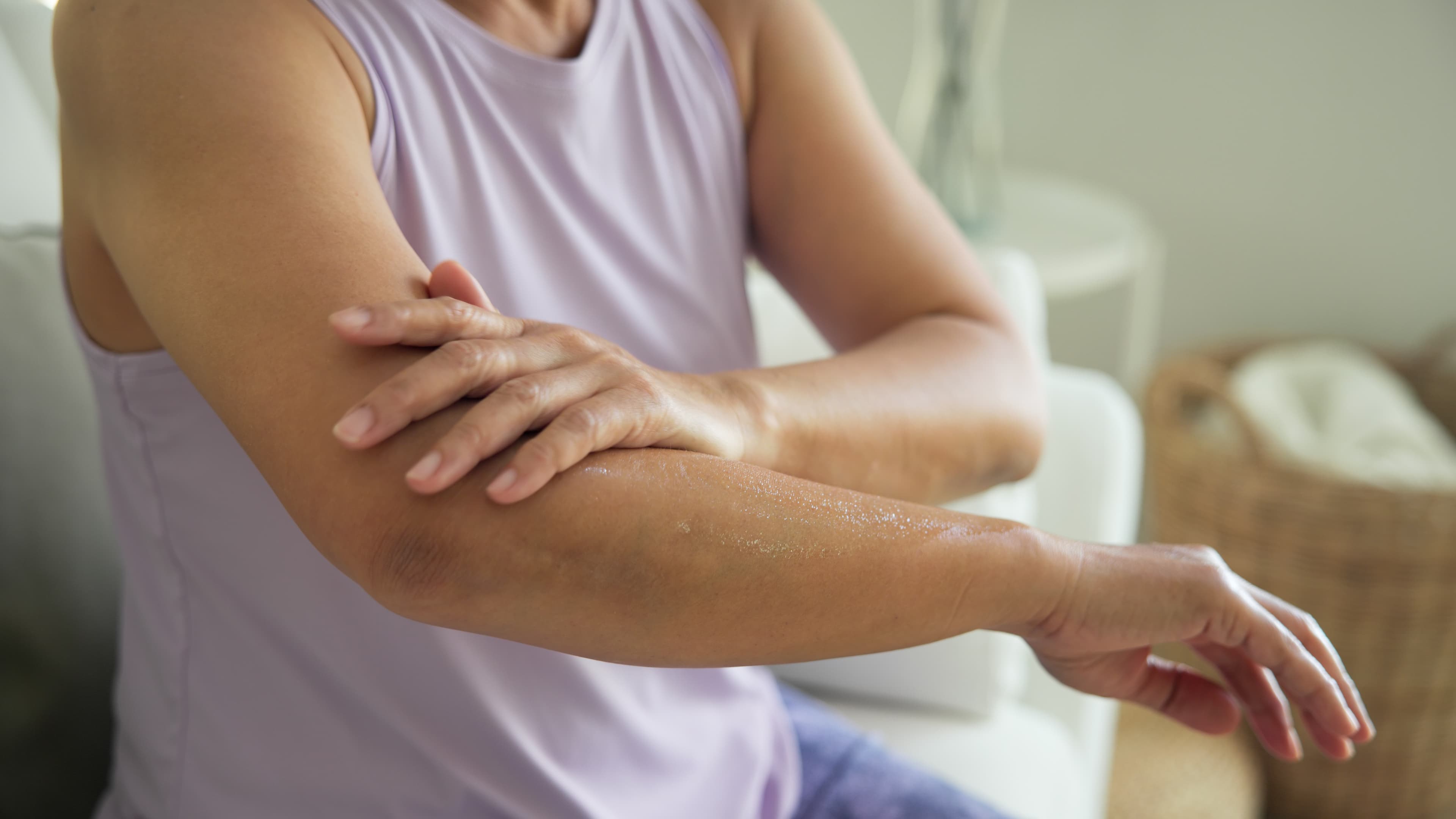 Contact or Allergic Dermatitis