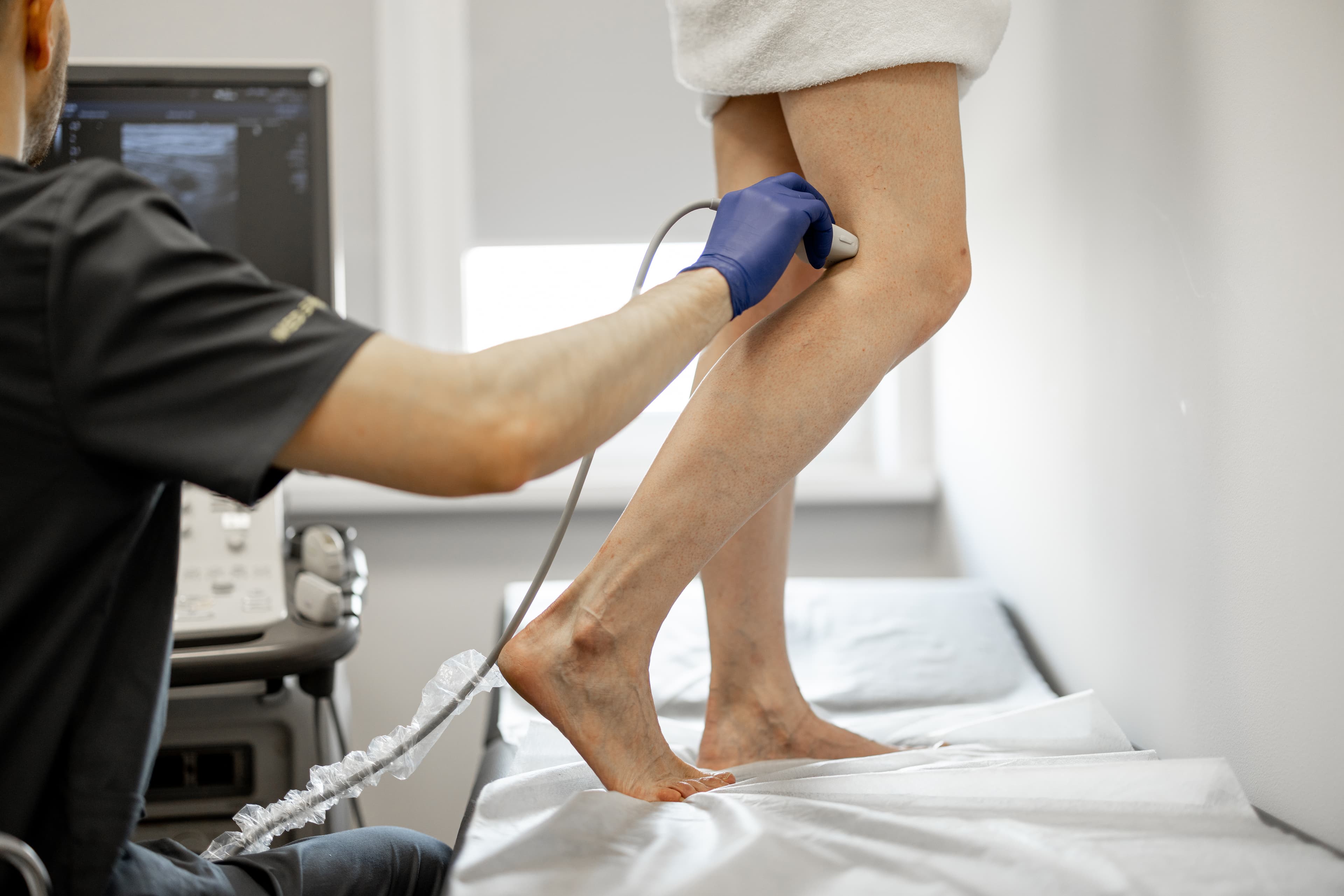 Venous stripping/ligation
