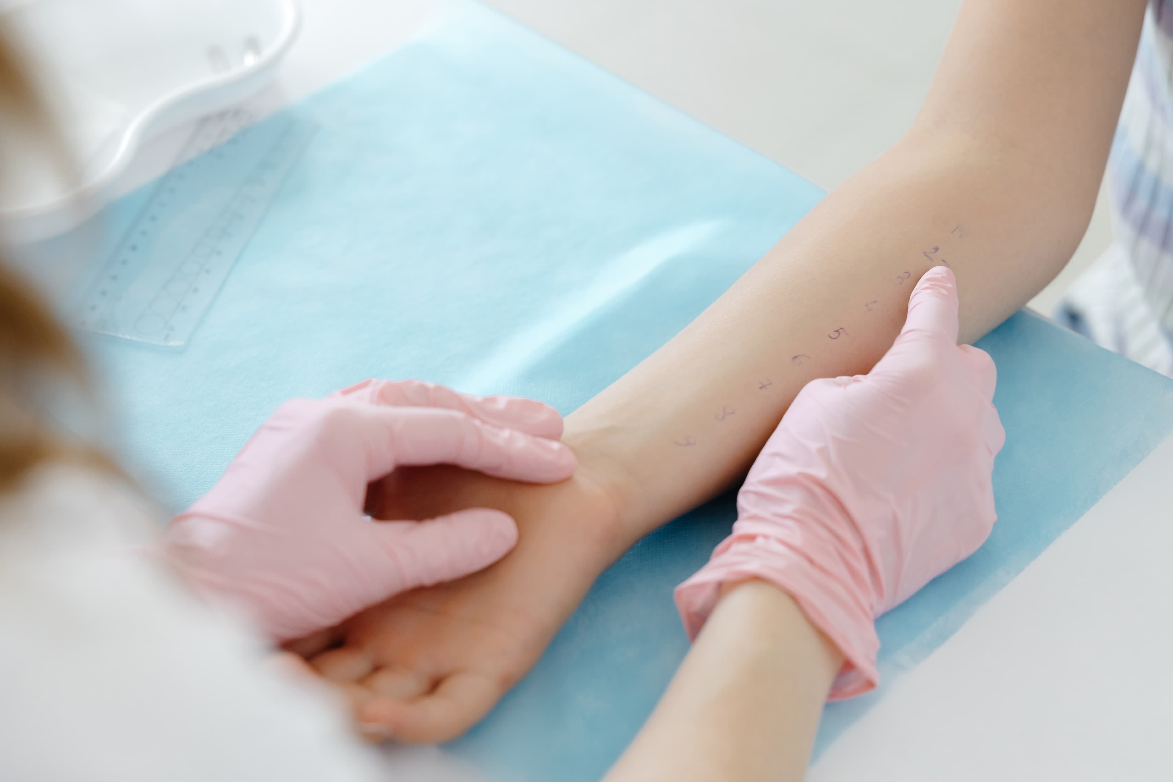 Lymphedema surgical decompression