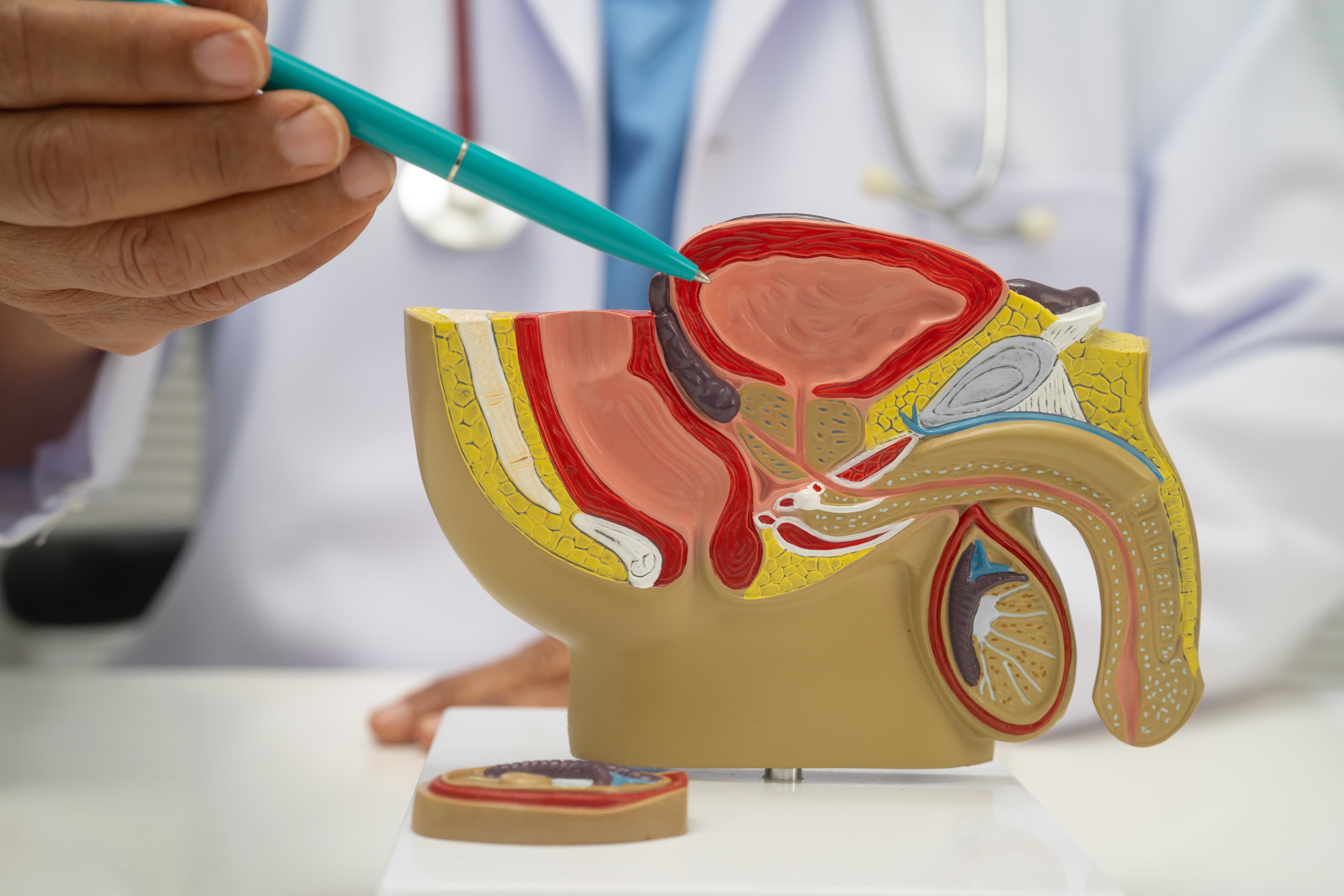 Prostate biopsy