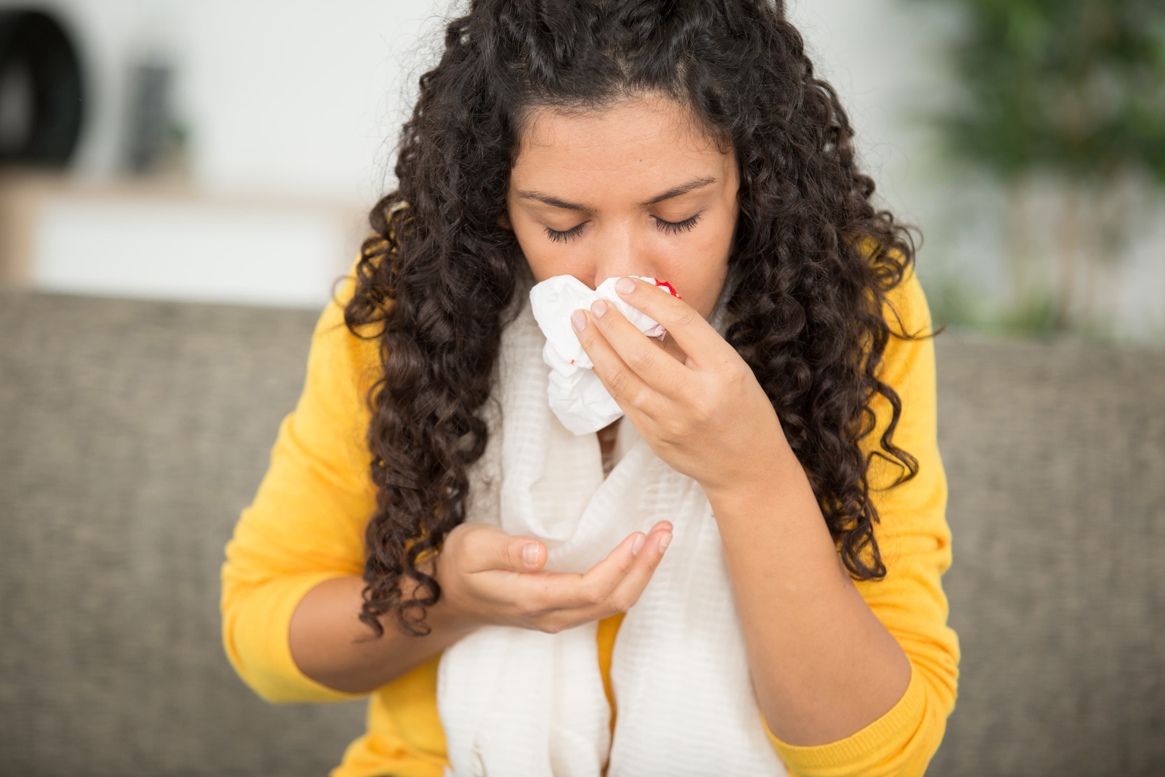 Epistaxis (nosebleed) cauterization