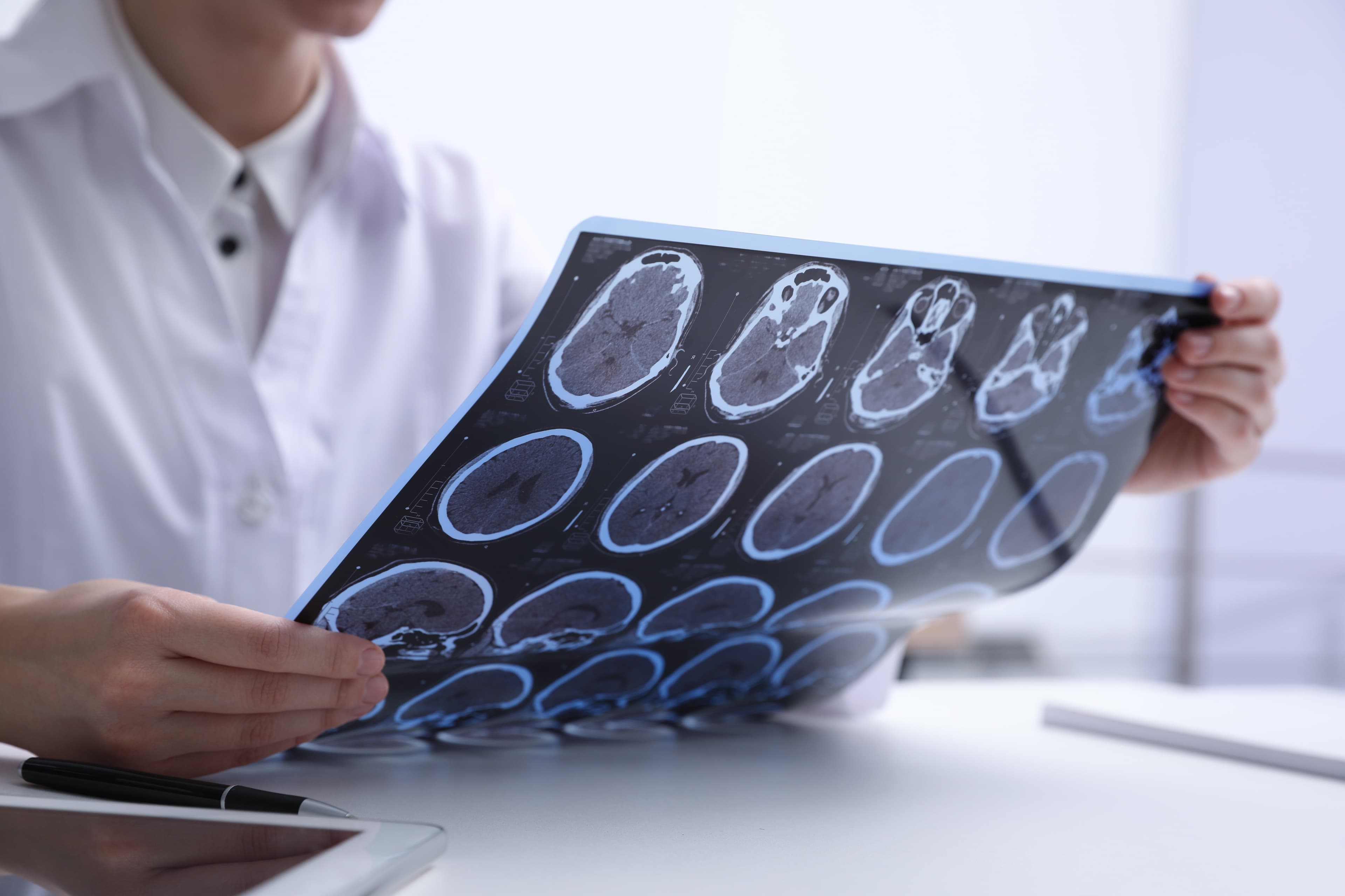 Multiple Sclerosis Consultation