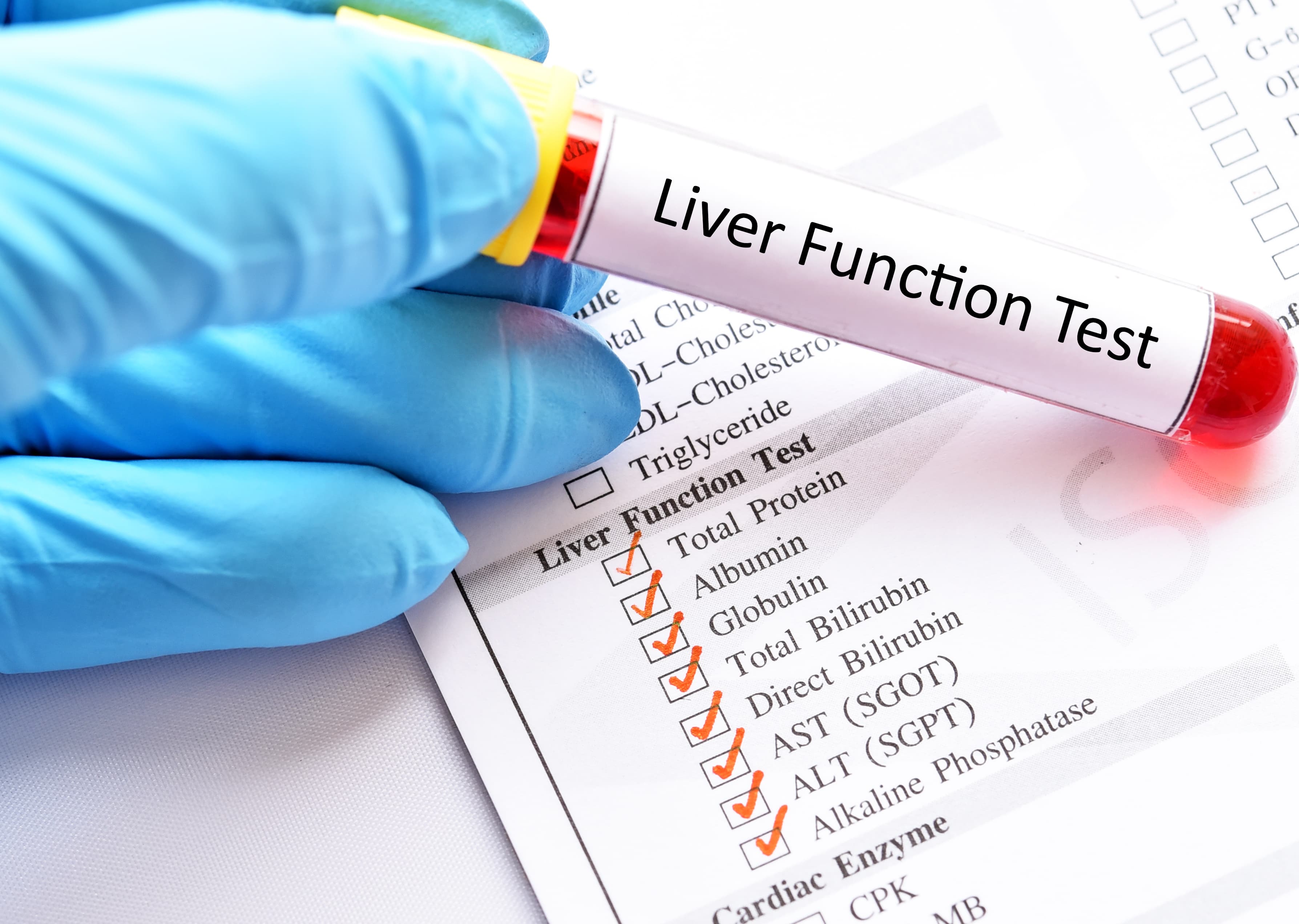 Fatty Liver Evaluation