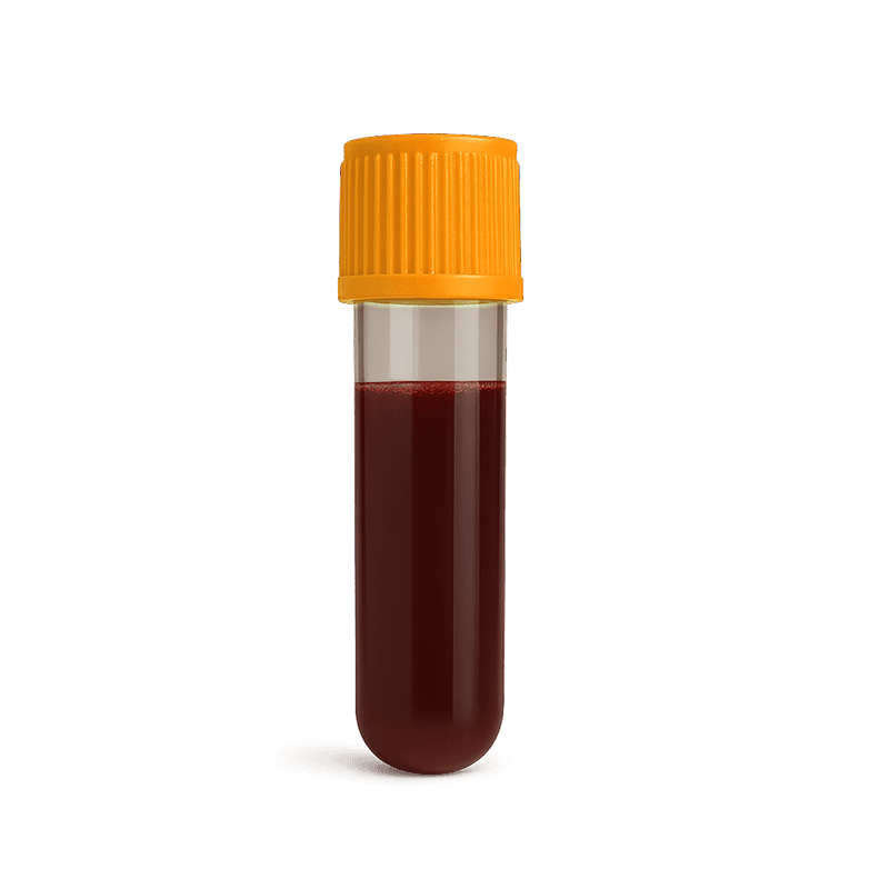 Complete blood count (CBC) test