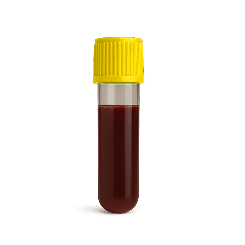 vitamin-d-test