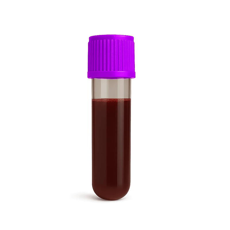 lipid-panel-plus