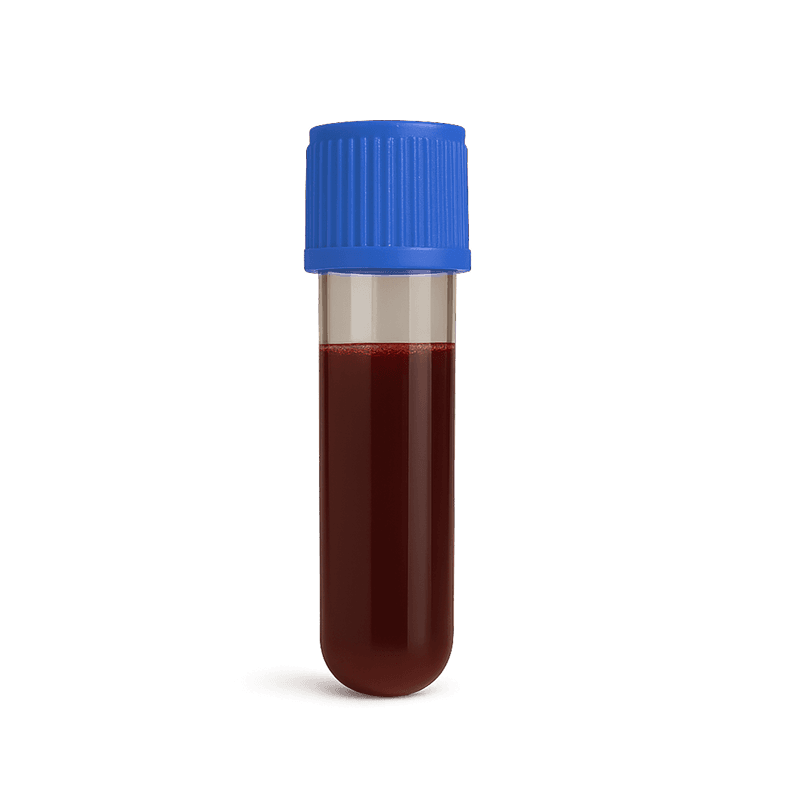 Thyroid Panel with TSH